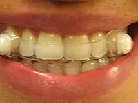 Snortec Sàrl