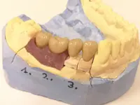 Zahnarzt Dr. med. dent. Franck R. Tolen - Klicken Sie, um das Bild 5 in einer Lightbox vergrössert darzustellen