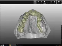 oral engineering ag