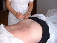 Acupuncture SinoSanté Morges - Klicken Sie, um das Bild 2 in einer Lightbox vergrössert darzustellen