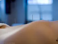 Akupunktur & TCM Heidi Gsteiger