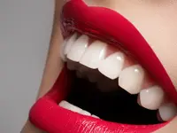 Naturlife Dental Mendrisio - Dr. Bontempelli Lorenzo