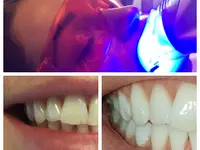 Dentalhygiene Tschan Claudia - Klicken Sie, um das Bild 7 in einer Lightbox vergrössert darzustellen