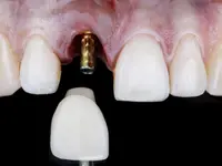 Clinique Dentaire d'Onex