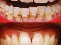 ORTHOLIGHT Orthodontie