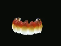 dental moeschli.ch ag - Klicken Sie, um das Bild 1 in einer Lightbox vergrössert darzustellen