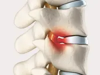 Physiotherapie Heiniger und Psychologische Körperarbeit - Klicken Sie, um das Bild 8 in einer Lightbox vergrössert darzustellen