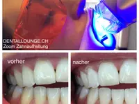 Dentalhygiene Tschan Claudia - Klicken Sie, um das Bild 9 in einer Lightbox vergrössert darzustellen