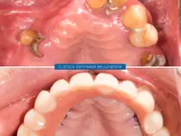 Clinica Dentaria Bellinzona Schulthess & Ottobrelli - Klicken Sie, um das Bild 4 in einer Lightbox vergrössert darzustellen