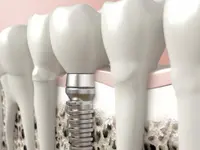 Praxis für Oralchirurgie und Implantologie Zürich Dr. Georg Damerau