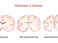 NeurologiePraxis dr. Celik - Klicken Sie, um das Bild 2 in einer Lightbox vergrössert darzustellen