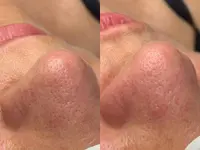 Institut de beauté A fleur de peau