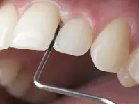 K-Dent médecine dentaire Zahnmedizin