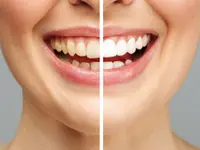 Clinica Dentaria Tre Valli Schulthess & Ottobrelli