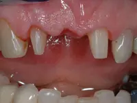 Gutzwiller Dental