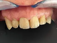 DentalLook Sagl - Klicken Sie, um das Bild 1 in einer Lightbox vergrössert darzustellen