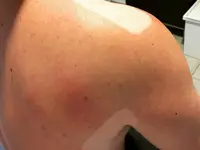Fisioterapia Mingolini Sagl