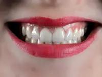 Vinci Dental Concept SA - Klicken Sie, um das Bild 3 in einer Lightbox vergrössert darzustellen