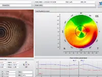 Muller Janz Opticiens - Klicken Sie, um das Bild 13 in einer Lightbox vergrössert darzustellen