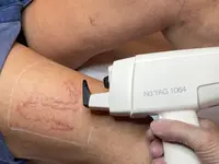 CALLICROMIA LASER STUDIO di Pagliuca Michela