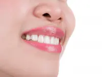 EE Orthodontics SA - Klicken Sie, um das Bild 3 in einer Lightbox vergrössert darzustellen