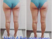 Beauty Werkstatt Body & Face - Klicken Sie, um das Bild 17 in einer Lightbox vergrössert darzustellen