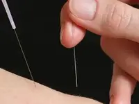 Praxis für Chinesische Medizin Brugg