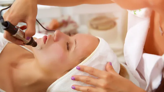 Microneedling Preise