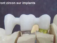 ARCADENT SA