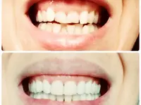 ORTHOLIGHT Orthodontie
