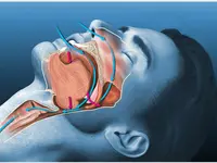 Orthodontie Lancy