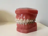 YLC ORTHODONTIE SA - Klicken Sie, um das Bild 3 in einer Lightbox vergrössert darzustellen