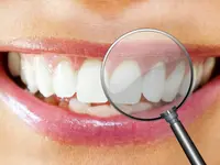 Zahnprothetik Vasi-Dental