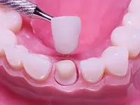K-Dent médecine dentaire Zahnmedizin