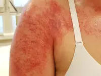 Cabinet Kundaria Naturopathe avec diplôme fédéral en MTC