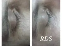 RDS Esthétique - Institut de beauté - Le Lignon Vernier Genève - Klicken Sie, um das Bild 6 in einer Lightbox vergrössert darzustellen