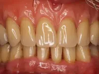 mundwerk dental GmbH - Klicken Sie, um das Bild 2 in einer Lightbox vergrössert darzustellen