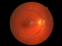 Fleury Opticiens SA