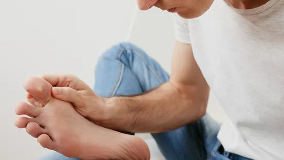 Warzen beim Hautarzt