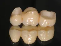 Gutzwiller Dental - Klicken Sie, um das Bild 5 in einer Lightbox vergrössert darzustellen