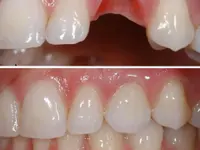 Müller Dental-Technology - Klicken Sie, um das Bild 8 in einer Lightbox vergrössert darzustellen