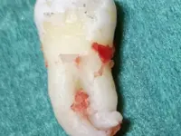 Zahnarzt Dr. med. dent. Franck R. Tolen