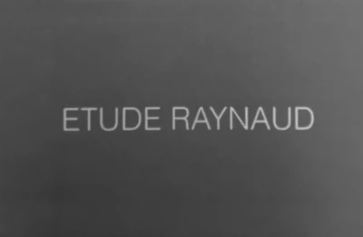 Etude Raynaud