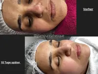 Glamour Esthétique