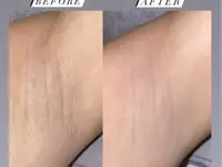Reshine Beauty GmbH