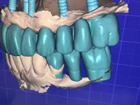 DentalLook Sagl - Klicken Sie, um das Bild 7 in einer Lightbox vergrössert darzustellen