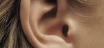 Otoplastie (oreilles décollées)