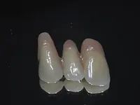 Gutzwiller Dental - cliccare per ingrandire l’immagine 4 in una lightbox