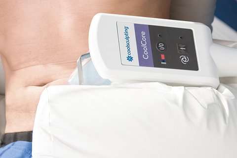 Cryolipolyse CoolSculpting