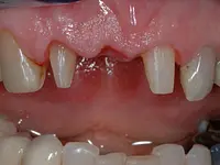 Gutzwiller Dental - Klicken Sie, um das Bild 6 in einer Lightbox vergrössert darzustellen